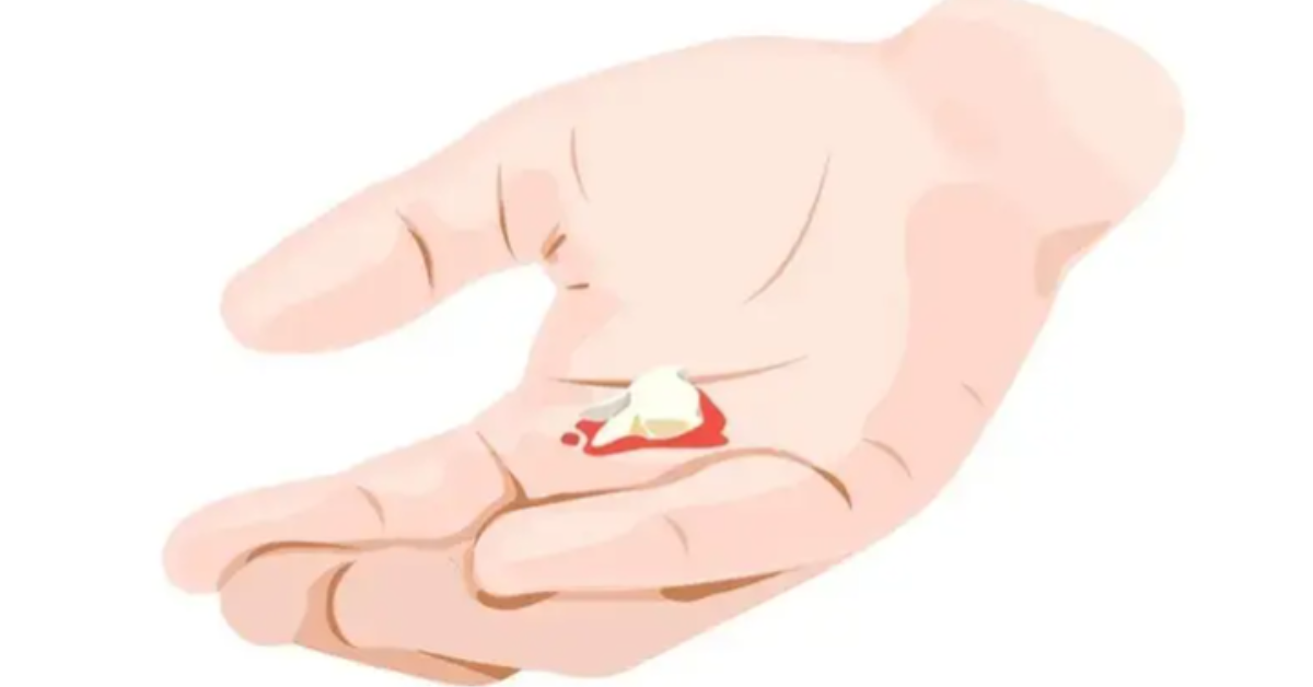 کیا دانتوں کا گرنا خطرے کی گھنٹی ہے؟ جانیں ماہرین کی رائے